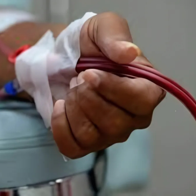 Rising Kidney Disease Among Young Kenyans