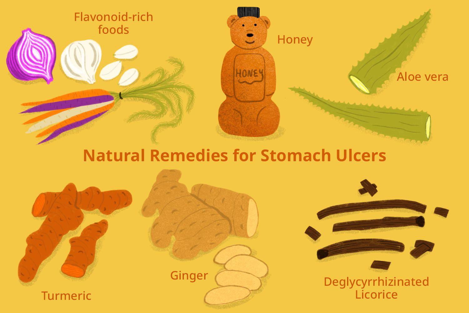 remedies for ulcers